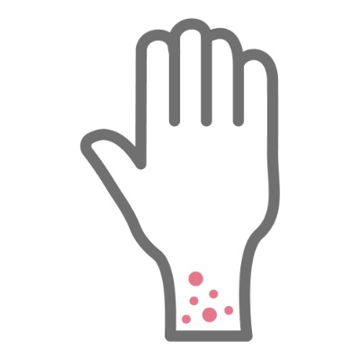 健康づくりピックアップ情報 アレルギー対策